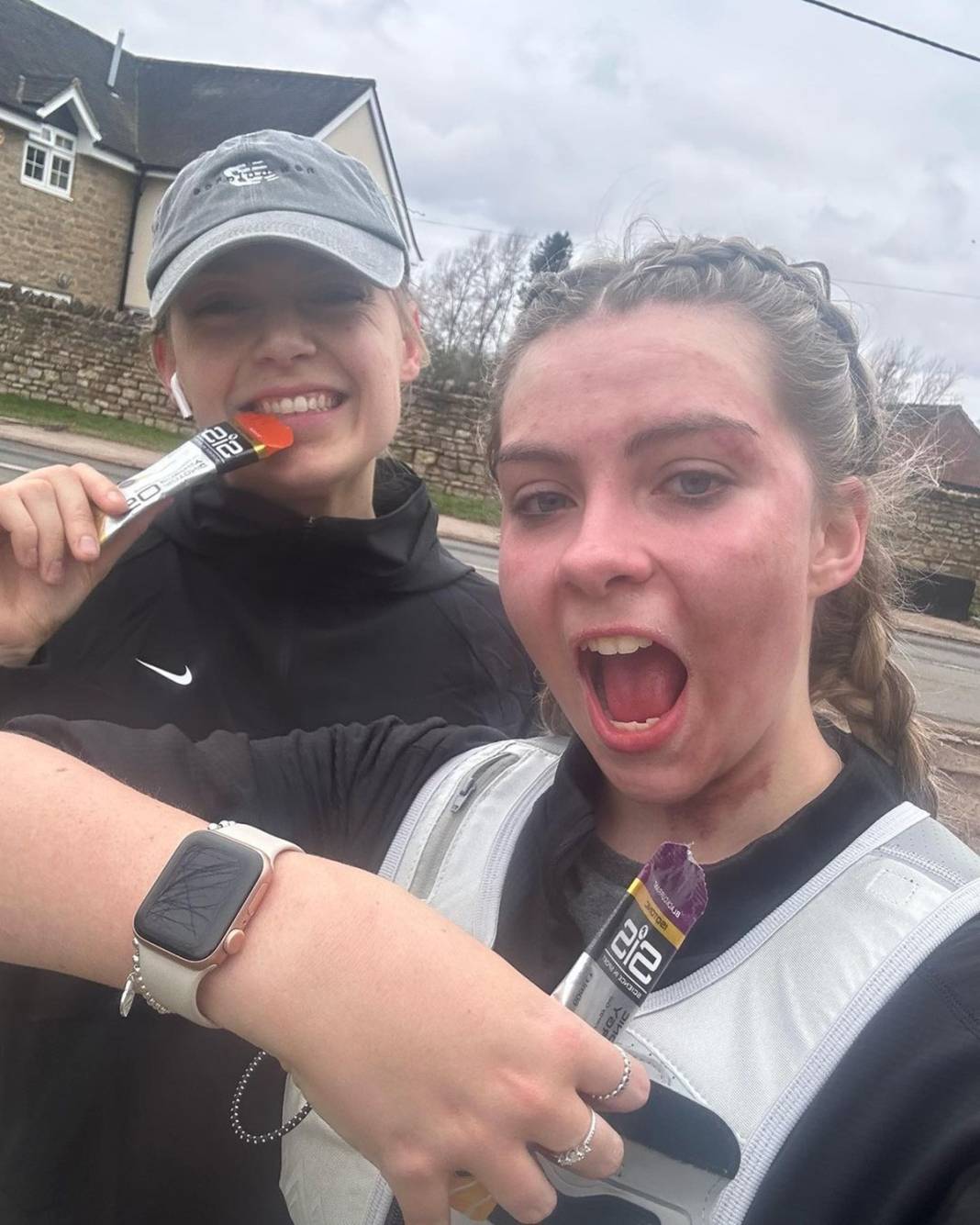 Basit bir uçuk zannetti, korkunç hastalığa yakalandı! Doktorlar bile teşhis koyamadı 18